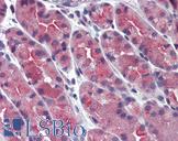 ERP44 Antibody - Anti-ERP44 / TXNDC4 antibody IHC of human stomach. Immunohistochemistry of formalin-fixed, paraffin-embedded tissue after heat-induced antigen retrieval.