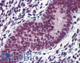 EWSR1 / EWS Antibody - Anti-EWSR1 antibody IHC of human uterus. Immunohistochemistry of formalin-fixed, paraffin-embedded tissue after heat-induced antigen retrieval. Antibody concentration 3.75 ug/ml.