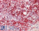 F13A1 / Factor XIIIa Antibody - Human Spleen: Formalin-Fixed, Paraffin-Embedded (FFPE)