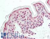 FAM193B Antibody - Anti-FAM193B antibody IHC staining of human skin. Immunohistochemistry of formalin-fixed, paraffin-embedded tissue after heat-induced antigen retrieval.