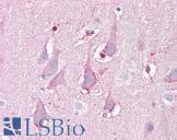 FBXL16 Antibody - Anti-FBXL16 antibody IHC of human brain, cortex. Immunohistochemistry of formalin-fixed, paraffin-embedded tissue after heat-induced antigen retrieval. Antibody concentration 5 ug/ml.