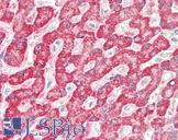 FH / Fumarase / MCL Antibody - Human Liver: Formalin-Fixed, Paraffin-Embedded (FFPE)