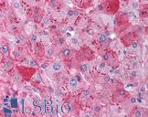 Fibrinogen Antibody - Anti-Fibrinogen antibody IHC of human liver. Immunohistochemistry of formalin-fixed, paraffin-embedded tissue after heat-induced antigen retrieval. Antibody concentration 5 ug/ml.