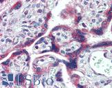 FMR1 / FMRP Antibody - Anti-FMR1 antibody IHC of human placenta. Immunohistochemistry of formalin-fixed, paraffin-embedded tissue after heat-induced antigen retrieval. Antibody concentration 2.5 ug/ml.