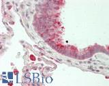 FOLR1 / Folate Receptor Alpha Antibody - Human Lung: Formalin-Fixed, Paraffin-Embedded (FFPE)