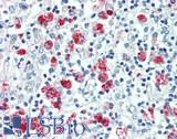 FOLR3 Antibody - Human Thymus: Formalin-Fixed, Paraffin-Embedded (FFPE)