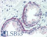 FOXO3 / FOXO3A Antibody - Anti-FOXO3A antibody IHC of human prostate. Immunohistochemistry of formalin-fixed, paraffin-embedded tissue after heat-induced antigen retrieval. Antibody dilution 1:100.