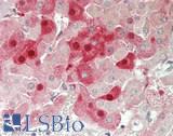 FSHB / FSH Beta Antibody - Human Adrenal: Formalin-Fixed, Paraffin-Embedded (FFPE)