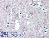 GABBR1 / GABA B Receptor 1 Antibody - Anti-GABBR1 antibody IHC of human brain, cortex. Immunohistochemistry of formalin-fixed, paraffin-embedded tissue after heat-induced antigen retrieval. Antibody concentration 3.75 ug/ml.