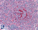 GABPB1 Antibody - Anti-GABPB1 antibody IHC of human spleen. Immunohistochemistry of formalin-fixed, paraffin-embedded tissue after heat-induced antigen retrieval. Antibody concentration 3.75 ug/ml.