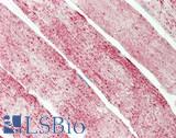 GBAS Antibody - Human Skeletal Muscle: Formalin-Fixed, Paraffin-Embedded (FFPE)
