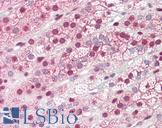 GBP6 Antibody - Anti-GBP6 antibody IHC staining of human adrenal. Immunohistochemistry of formalin-fixed, paraffin-embedded tissue after heat-induced antigen retrieval.