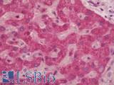 GCLC Antibody - Human Liver: Formalin-Fixed, Paraffin-Embedded (FFPE)