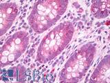 GJA3 / CX46 / Connexin 46 Antibody - Anti-GJA3 / Connexin 46 antibody IHC of human colon. Immunohistochemistry of formalin-fixed, paraffin-embedded tissue after heat-induced antigen retrieval. Antibody dilution 10 ug/ml.