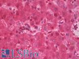 GLB1 / Beta-Galactosidase Antibody - Anti-GLB1 / Beta-Galactosidase antibody IHC staining of human liver. Immunohistochemistry of formalin-fixed, paraffin-embedded tissue after heat-induced antigen retrieval. Antibody concentration 10 ug/ml.