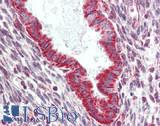 GLIPR2 Antibody - Human Uterus: Formalin-Fixed, Paraffin-Embedded (FFPE), at a concentration of 10 ug/ml. 