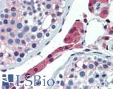 GLO1 / Glyoxalase I Antibody - Human Testis: Formalin-Fixed, Paraffin-Embedded (FFPE)