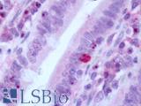 GLP2R Antibody - Human Small Intestine: Formalin-Fixed, Paraffin-Embedded (FFPE)