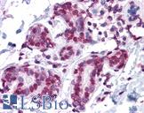 GMEB1 Antibody - Anti-GMEB1 antibody IHC of human breast. Immunohistochemistry of formalin-fixed, paraffin-embedded tissue after heat-induced antigen retrieval. Antibody concentration 5 ug/ml.