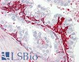 GPR55 Antibody - Anti-GPR55 antibody IHC staining of human prostate. Immunohistochemistry of formalin-fixed, paraffin-embedded tissue after heat-induced antigen retrieval.