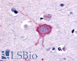 GRM2 / MGLUR2 Antibody - Anti-GRM2 / MGLUR2 antibody IHC of human brain, neurons and glia. Immunohistochemistry of formalin-fixed, paraffin-embedded tissue after heat-induced antigen retrieval.