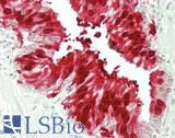 GSTA2 Antibody - Human Lung, Respiratory Epithelium: Formalin-Fixed, Paraffin-Embedded (FFPE)