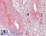 GUSB / Beta Glucuronidase Antibody - Human Uterus: Formalin-Fixed, Paraffin-Embedded (FFPE)