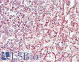 HADHA Antibody - Human Spleen: Formalin-Fixed, Paraffin-Embedded (FFPE)