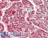 HADHB Antibody - Human Pancreas: Formalin-Fixed, Paraffin-Embedded (FFPE)
