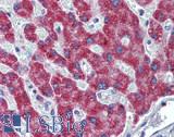HAO1 Antibody - Human Liver: Formalin-Fixed, Paraffin-Embedded (FFPE)