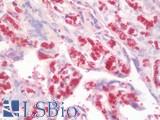 HBA1+2 / Hemoglobin Alpha Antibody - Anti-HBA2 / Hemoglobin Alpha 2 antibody IHC staining of human placenta. Immunohistochemistry of formalin-fixed, paraffin-embedded tissue after heat-induced antigen retrieval. Antibody dilution 1:250.