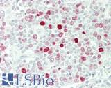 Histone H1 Antibody - Human Small Intestine, MALT: Formalin-Fixed, Paraffin-Embedded (FFPE)
