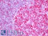 HLA Class II Histocompatibility Antigen, DRB1-3 Antibody - Human Tonsil: Formalin-Fixed, Paraffin-Embedded (FFPE).  This image was taken for the unconjugated form of this product. Other forms have not been tested.