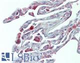 HNF1A / HNF1 Antibody - Human Lung: Formalin-Fixed, Paraffin-Embedded (FFPE)