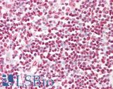 HNRNPD / AUF1 Antibody - Anti-HNRNPD / AUF1 antibody IHC of human tonsil. Immunohistochemistry of formalin-fixed, paraffin-embedded tissue after heat-induced antigen retrieval. Antibody dilution 1:100.