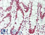 HNRPA1 / HnRNP A1 Antibody - Human Small Intestine: Formalin-Fixed, Paraffin-Embedded (FFPE)