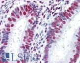 HNRPM / HNRNPM Antibody - Anti-HNRNPM / HNRPM antibody IHC of human uterus. Immunohistochemistry of formalin-fixed, paraffin-embedded tissue after heat-induced antigen retrieval. Antibody concentration 5 ug/ml.