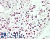 HOXA3 Antibody - Human Testis: Formalin-Fixed, Paraffin-Embedded (FFPE)