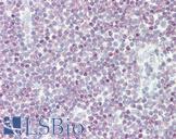 HOXB6 Antibody - Anti-HOXB6 antibody IHC staining of human tonsil. Immunohistochemistry of formalin-fixed, paraffin-embedded tissue after heat-induced antigen retrieval.