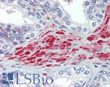 HRAS / H-Ras Antibody - Human Prostate: Formalin-Fixed, Paraffin-Embedded (FFPE)