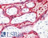 HSD3B1 Antibody - Anti-HSD3B1 antibody IHC staining of human placenta. Immunohistochemistry of formalin-fixed, paraffin-embedded tissue after heat-induced antigen retrieval.