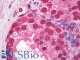 HSP40 Antibody - Anti-HSP40 antibody IHC of human prostate. Immunohistochemistry of formalin-fixed, paraffin-embedded tissue after heat-induced antigen retrieval. Antibody dilution 1:100.