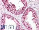 HSPE1 / HSP10 / Chaperonin 10 Antibody - Anti-HSPE1 / CPN10 antibody IHC of human prostate. Immunohistochemistry of formalin-fixed, paraffin-embedded tissue after heat-induced antigen retrieval. Antibody dilution 1:100.