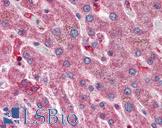 HYAL1 Antibody - Anti-HYAL1 antibody IHC of human liver. Immunohistochemistry of formalin-fixed, paraffin-embedded tissue after heat-induced antigen retrieval. Antibody concentration 5 ug/ml.
