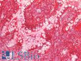 I-BABP / FABP6 Antibody - Human Small Intestine: Formalin-Fixed, Paraffin-Embedded (FFPE)