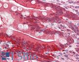 I-FABP / FABP2 Antibody - Anti-FABP2 antibody IHC of human small intestine. Immunohistochemistry of formalin-fixed, paraffin-embedded tissue after heat-induced antigen retrieval. Antibody concentration 5 ug/ml.