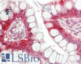 I-FABP / FABP2 Antibody - Human Small Intestine: Formalin-Fixed, Paraffin-Embedded (FFPE)