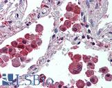 IDE Antibody - Anti-IDE antibody IHC of human lung. Immunohistochemistry of formalin-fixed, paraffin-embedded tissue after heat-induced antigen retrieval. Antibody concentration 2.5 ug/ml.