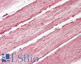 IDH2 Antibody - Anti-IDH / IDH2 antibody IHC of human skeletal muscle. Immunohistochemistry of formalin-fixed, paraffin-embedded tissue after heat-induced antigen retrieval. Antibody dilution 3.75 ug/ml.