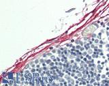 IHH Antibody - Human Fibroblasts: Formalin-Fixed, Paraffin-Embedded (FFPE).  This image was taken for the unconjugated form of this product. Other forms have not been tested.
